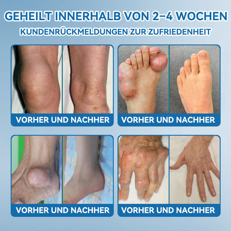 【⏰Promotion in the last 30 minutes!】