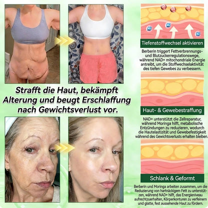 Offizieller Shop | 🩹🔬 GLORDENDA® Moringa Berberinex NAD+ 10-in-1 Nano-Mikronadel-Patch (Nur einmal täglich, sichtbare Veränderungen in 7 Tagen) ✅ Für Übergewicht, lockere Haut, Diabetes, Schlafapnoe, Gelenkprobleme und mehr