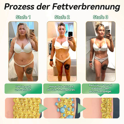 【Letzter Tag der Aktion – 80 % RABATT】 𝗞𝗲𝘆𝗲𝘀𝘀® 𝗚𝗟𝗣-𝟭 & 𝗠𝗮𝘁𝗿𝗶𝘅𝘆𝗹 𝟯𝟬𝟬𝟬 𝗦𝗰𝗵𝗹𝗮𝗻𝗸𝗵𝗲𝗶𝘁𝘀- & 𝗚𝗲𝘀𝘂𝗻𝗱𝗵𝗲𝗶𝘁𝘀-𝗧𝗿𝗼𝗽𝗳𝗲𝗻