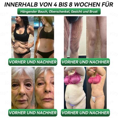 【Letzter Tag der Aktion – 80 % RABATT】 𝗞𝗲𝘆𝗲𝘀𝘀® 𝗚𝗟𝗣-𝟭 & 𝗠𝗮𝘁𝗿𝗶𝘅𝘆𝗹 𝟯𝟬𝟬𝟬 𝗦𝗰𝗵𝗹𝗮𝗻𝗸𝗵𝗲𝗶𝘁𝘀- & 𝗚𝗲𝘀𝘂𝗻𝗱𝗵𝗲𝗶𝘁𝘀-𝗧𝗿𝗼𝗽𝗳𝗲𝗻